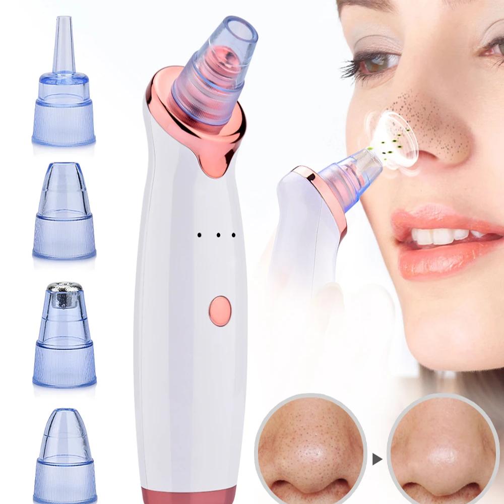 Blackhead Remover Vacuum Acne Cleaner Electric Pore Nose Cleaner Water Cycle Dead Skin Remover Deep Cleansin Facial Tool