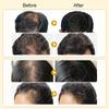 PURC Ginger Hair Growth Serum for Men Women - Hair Regrowth Thicken Thinning Hair Loss Treatment Hair Care