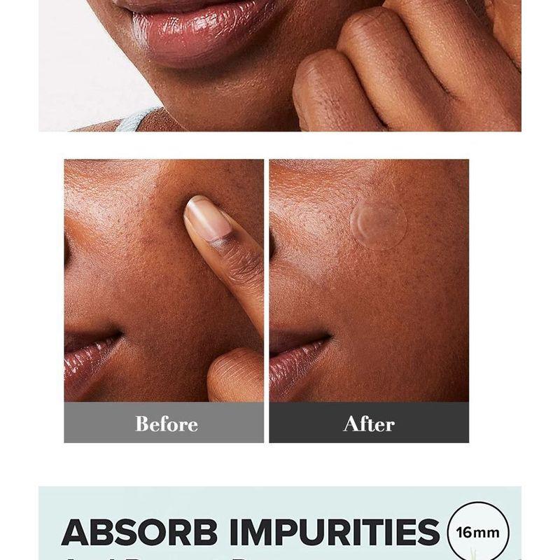 I DEW CARE - Timeout Blemish Patch - 4 Types