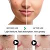 Acne and Spot Removing Cream Lightens Spots Brightens Skin Tone Moisturizes Skin Acne and Spots Skin Care and Repair Cream