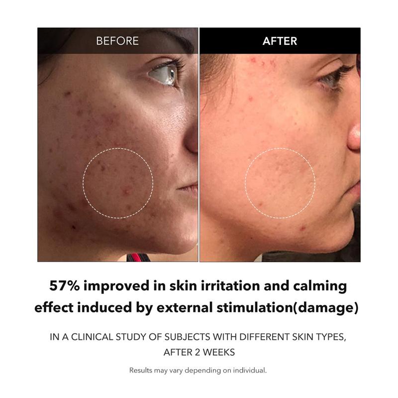 Aprilskin Sérum Clarifiant Carotène 37ml