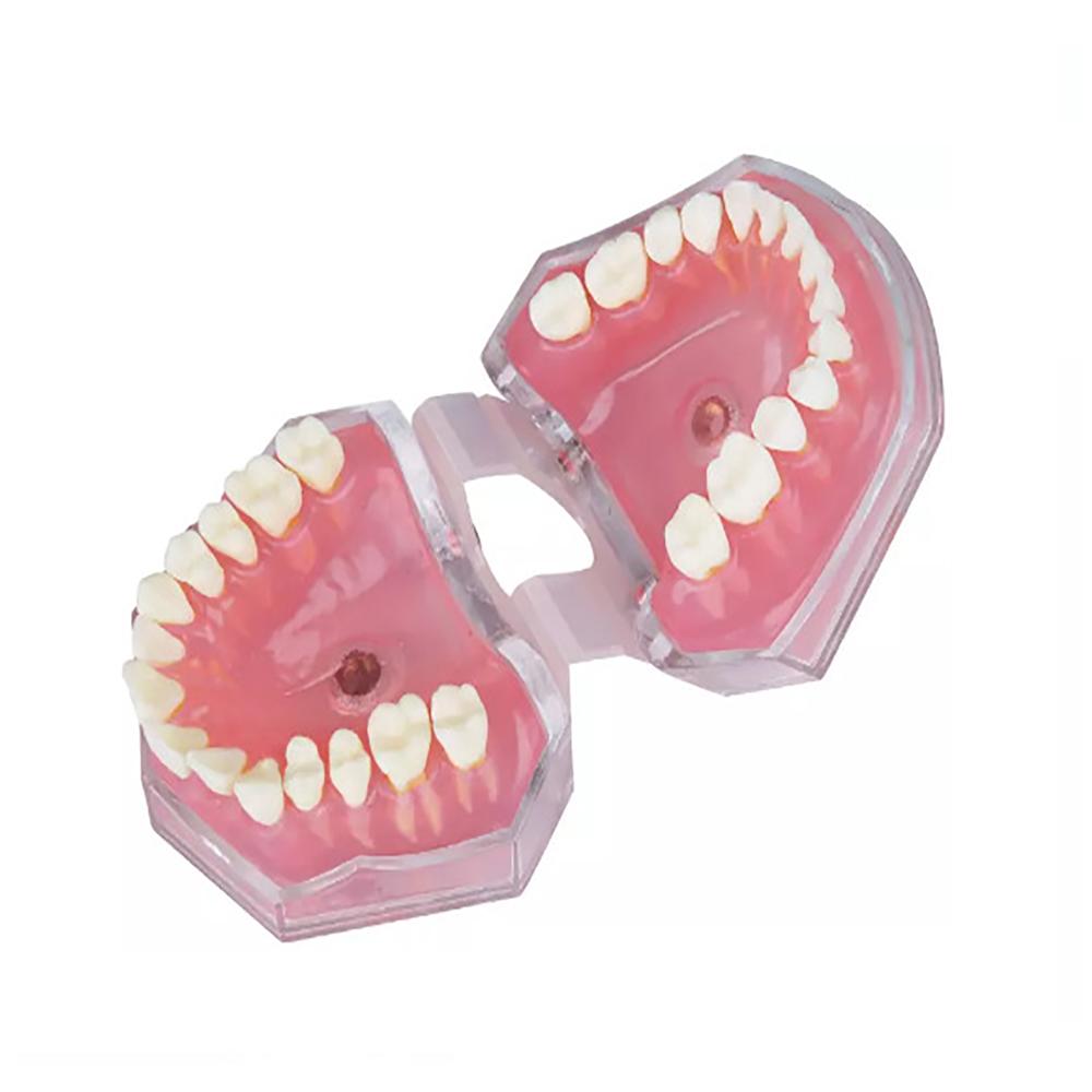 Dental Model with Removable Teeth Jaw Typodont Soft Gum Adult Standard Dentistry Teaching Studying Demonstration Teeth Model
