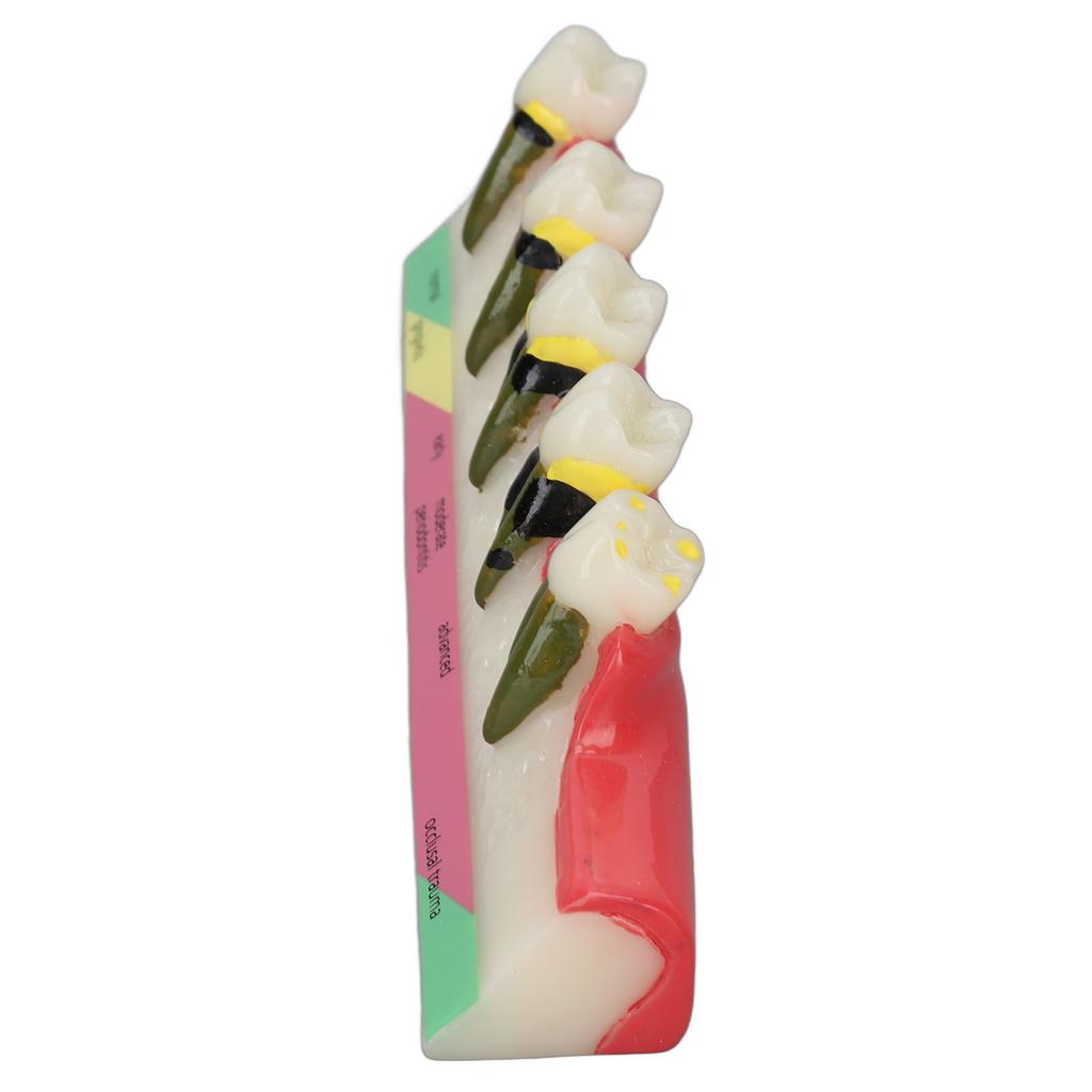 Dental Teeth Model Ceramic Clear Structure Oral Care Educational Periodontal Disease Model