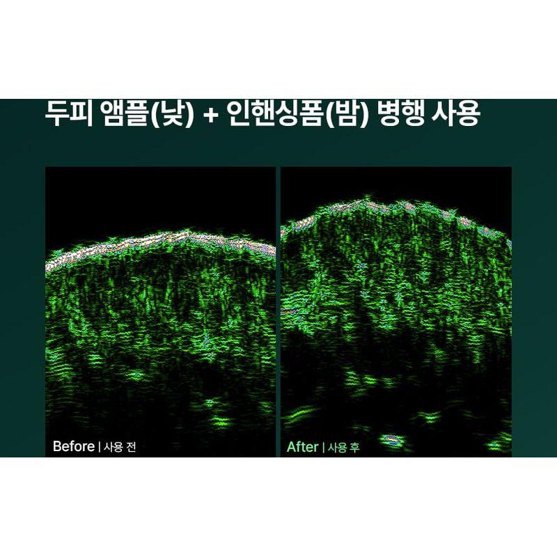 ViveLab - Revive Therapy Hair Scalp Enhancing Foam