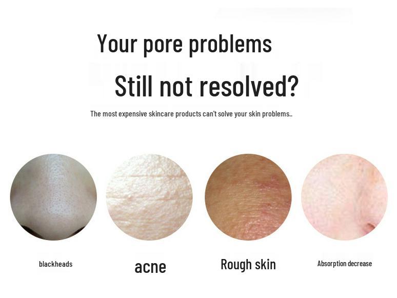 Ultrasonic Skin Scrubber: Face Lifting, Pore Cleaner & Blackhead Remover