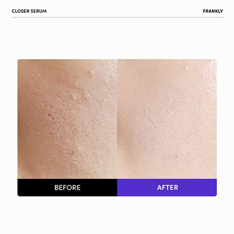 FRANKLY Closer Serum 100ml