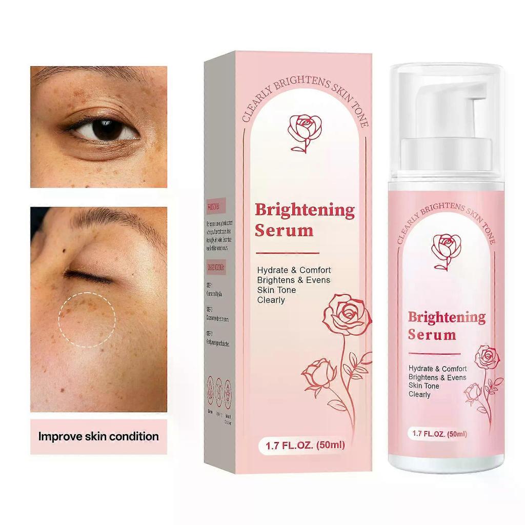 Dunkelfleckenentferner für Gesicht und Körper - Dunkelflecken-Korrekturserum für das Gesicht - Aufhellendes Serum - Braune Fleckenkorrektor gleicht den Hautton aus für alle Hauttypen