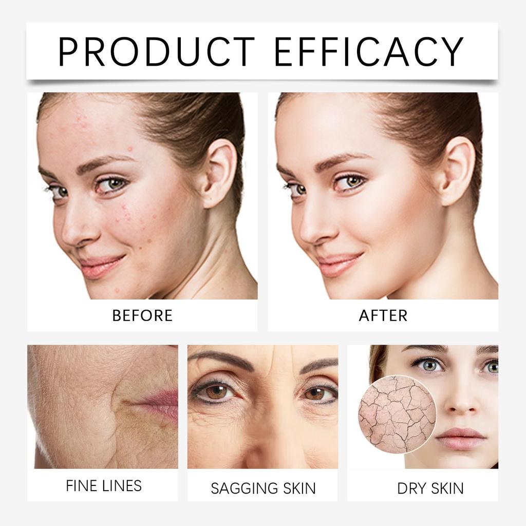Polypeptide Facial Serum Facial Skin Moisturizing, Nourishing, Brightening And Radiant Serum 30ml