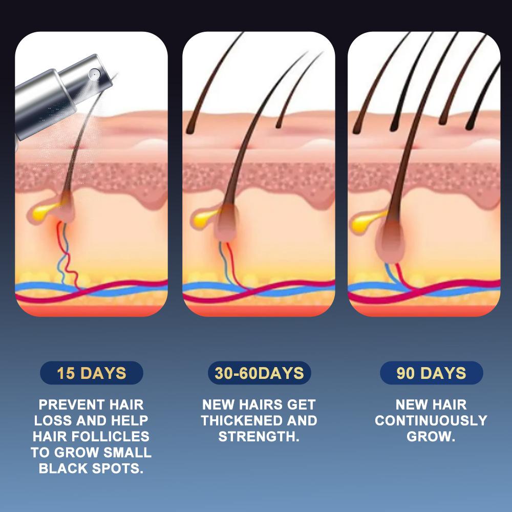 Sumifun 30 ML Ginger Hair Care Essence Spray,Hair Growth Essence Oil,Rapid Hair Growth Hair Nutrient Solution Scalp Care Repair Damaged Hair