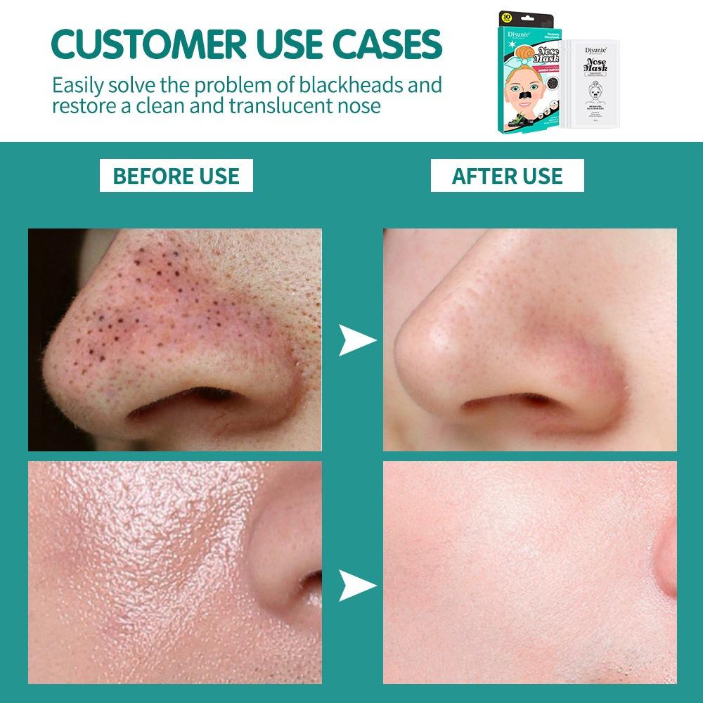 Disunie Bamboo Charcoal Blackhead Removal Nose Patch Moisturizing Pore Cleansing Acne Nose Mask Nose Patch