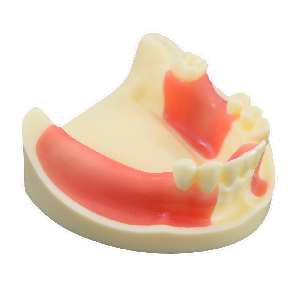Dental Model Dentistry Implant Practice Training Model For Cutting Implant And Suturing Practice with Cancellous Bone Dental Lab