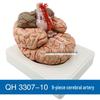 Qinghua 4D Anatomisches Modell des menschlichen Gehirns und zerebrovaskuläres Modell für die medizinische Ausbildung
