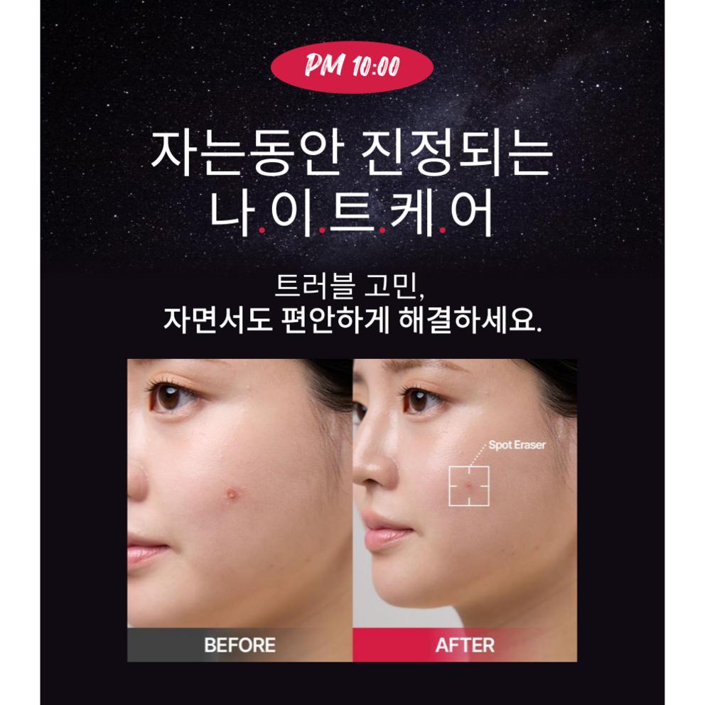 [Fisio:[Be] Removedor de Manchas Patch para Espinhas e Acne, Grande Capacidade, 114 Patches, Pacote com 2