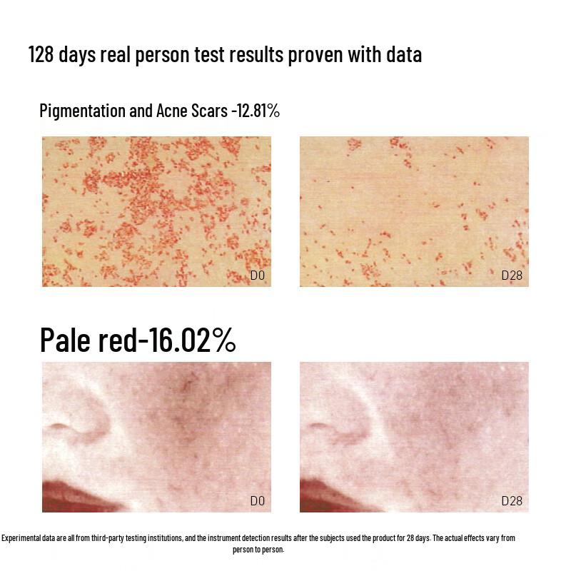 BiShengZhiYan Niacinamide Whitening & Hydrating Skincare Set