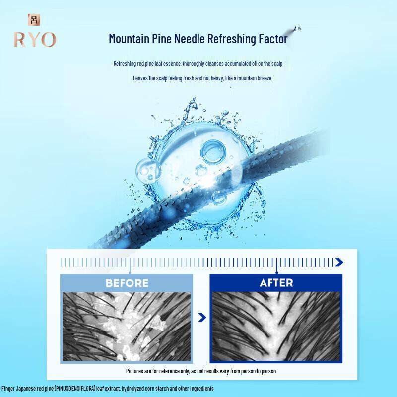 Ryo Blue Anti-Dandruff Oil Control Shampoo 400ml