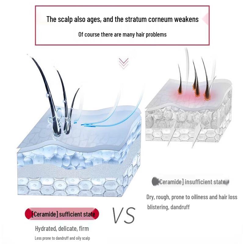 Sulei Scalp Refreshing Oil Control Anti-Dandruff Shampoo