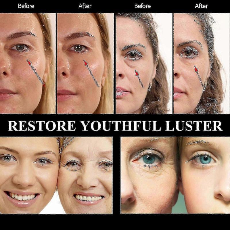 1pc Ouhoe Snake Venom Peptide Moisturizing Eye Cream Moisturizing, Lightening Fine Lines, Anti-aging And Anti-wrinkle | | 1PC