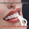 Children's Dental Plaque Wipes: Remove Pigmentation and Black Spots