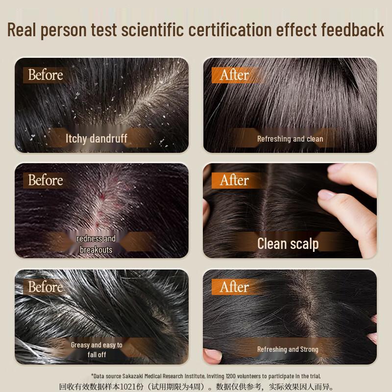 Sakasai Selenium Disulfide Folliculitis & Dandruff Treatment Shampoo