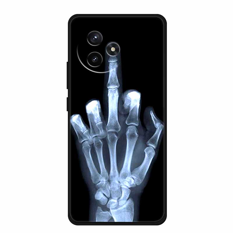 For Redmi K80 Ultra Lovely Owl Animals Phone Case Soft Silicone TPU Cases for Xiaomi RedmiK80 Ultra Shockproof Protective Funda