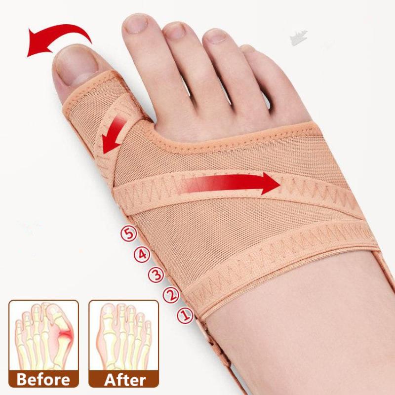 Adjustable Hallux Valgus Sleeve Spacer Separator Toe Corrector Fabric Bunion Corrector Breathable Sports Bunion Socks Running
