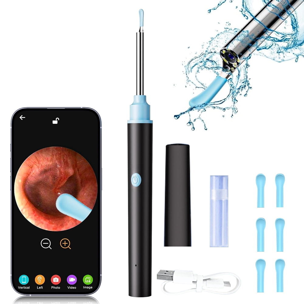 

Ouwald Ear Wax Removal, Ear Cleaner with Camera, Earwax Remover Tool with LED Light, Ear Camera with 6 Ear Spoon, Earwax Removal Kit for Ear Cleaning