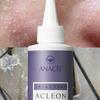 Acleon Sebum Removal Seboex 200ml (15ml Pore Ampoule Included)