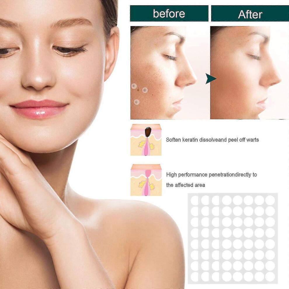 Natural Safe And Effective Ingredients Skin Tag Remover Patches And Improved Formulations Skin Tag Remover Patches