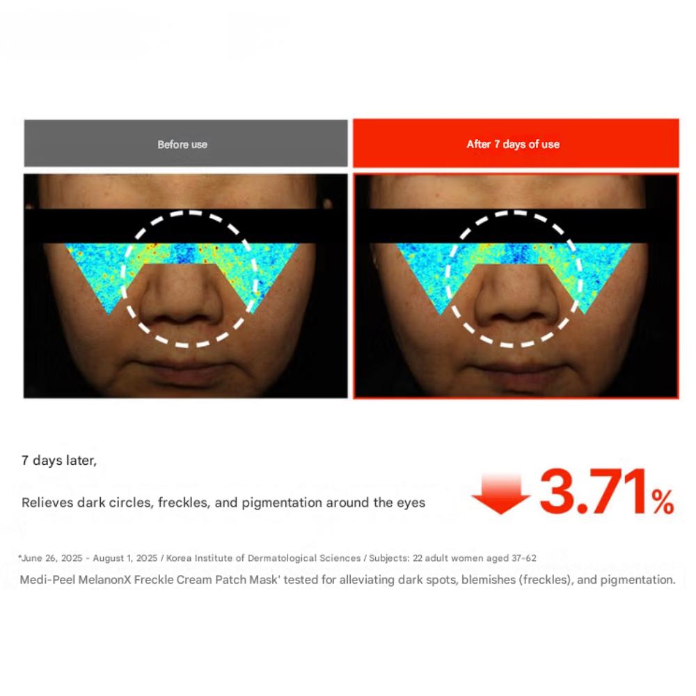 MediPeel MelanonX Freckle Cream Patch (2 sheets)