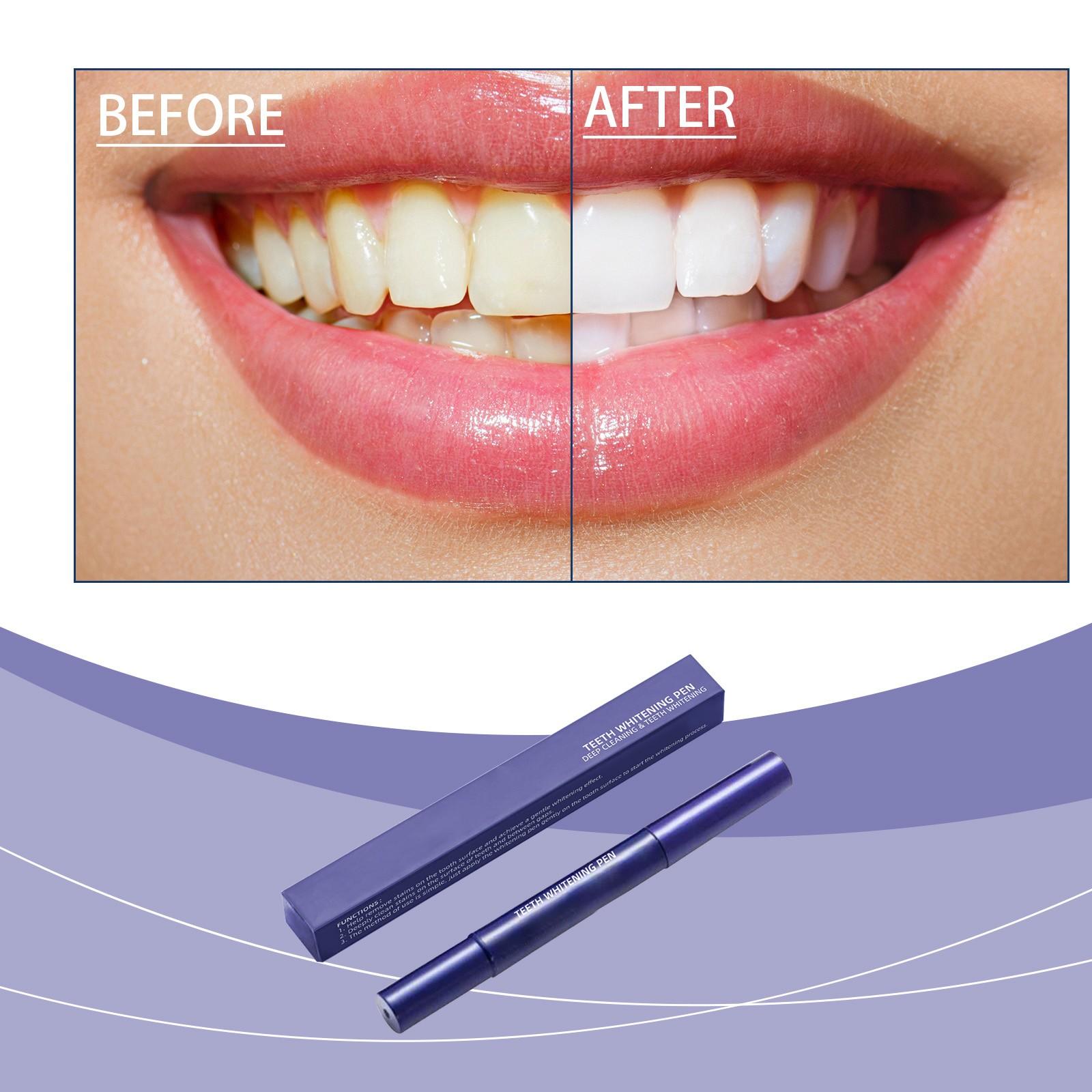 

Гель-карандаш для отбеливания зубов быстро окрашивает, портативен и подходит для отбеливания зубов в домашних условиях 2 мл One Size