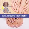 Ouhoe Nail Repair Solution Thickening Treatment For Ingrown Nails And Fungal Issues