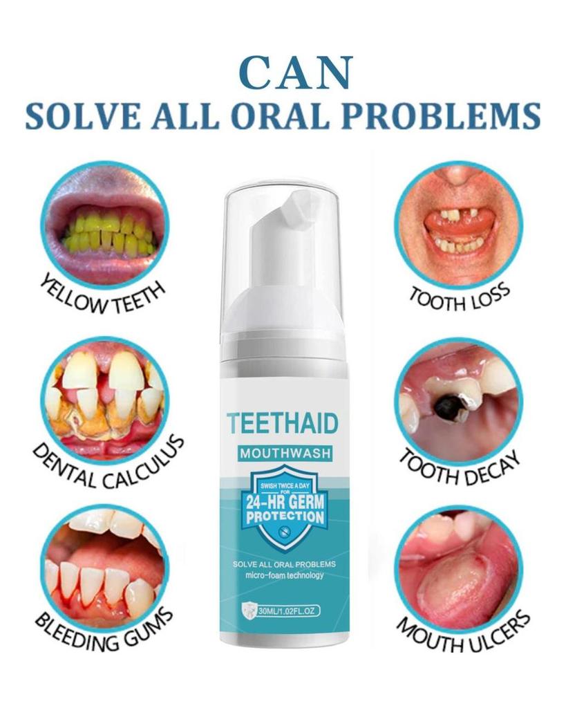 30ML Mousse Toothpaste Natural Ingredients Oral Care Food Grade User-friendly Teeth Mousse Foam