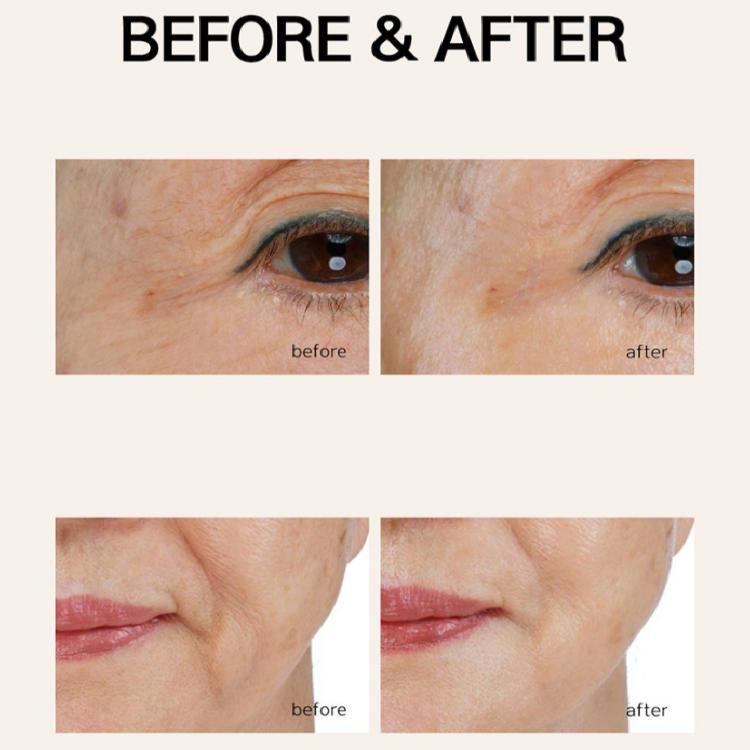 Cledbel Gold Collagen Lifting Ampullenbalsam 11g