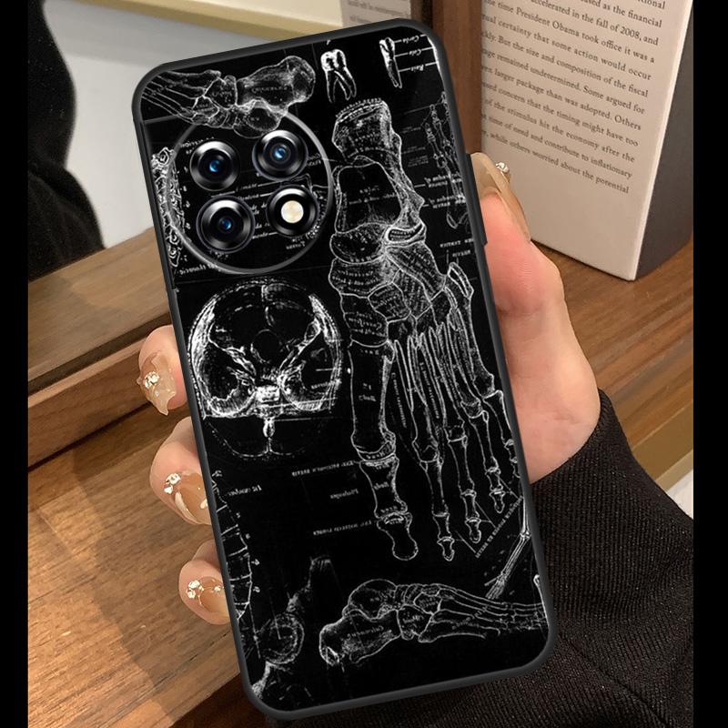 Medical Skeleton Anatomy Case For OnePlus 15 R 13T 13R 12R 10T 8T 13 12 11 9 10 Pro Nord 5 CE 4 2 3 Lite N20 N30 Cover