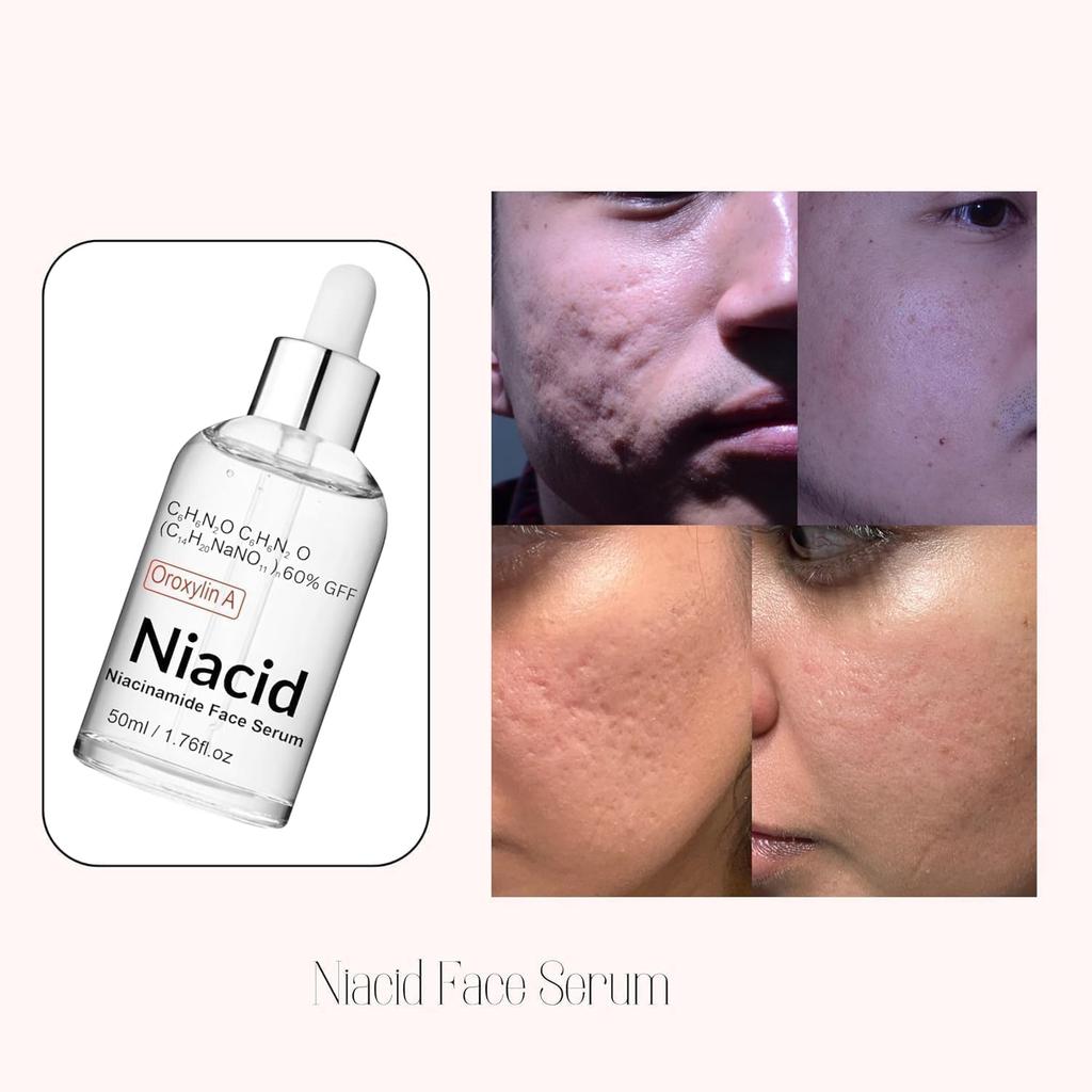 VIVAGLO Siero Viso Niacid Niacinamide 5% per Pelli Grasse Secche Miste Schiarente Protegge dal Sole Pori Dilatati Rassodante Cicatrici Pitting & Macchie Post-Acne Scure