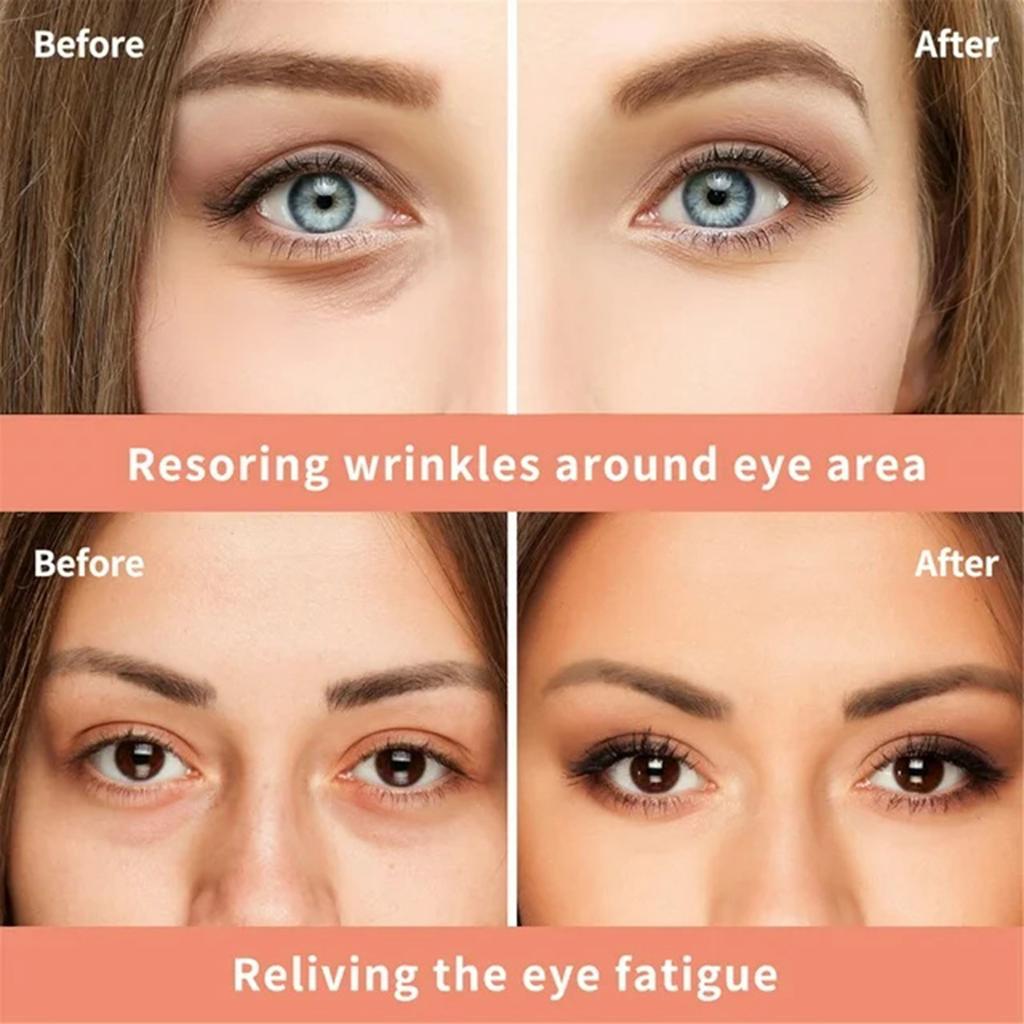 Anti-aging Eye Cream Cayman Silk Protein Eye Cream For Wrinkles, Fine Lines, Dark Circles, Puffiness & Bags, 20g