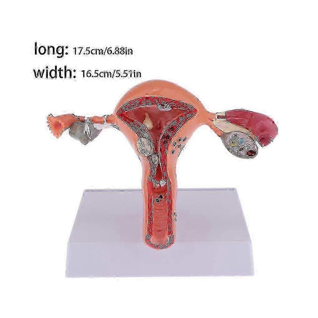 Female Uterus Structure Biological Models Educational Experiment o