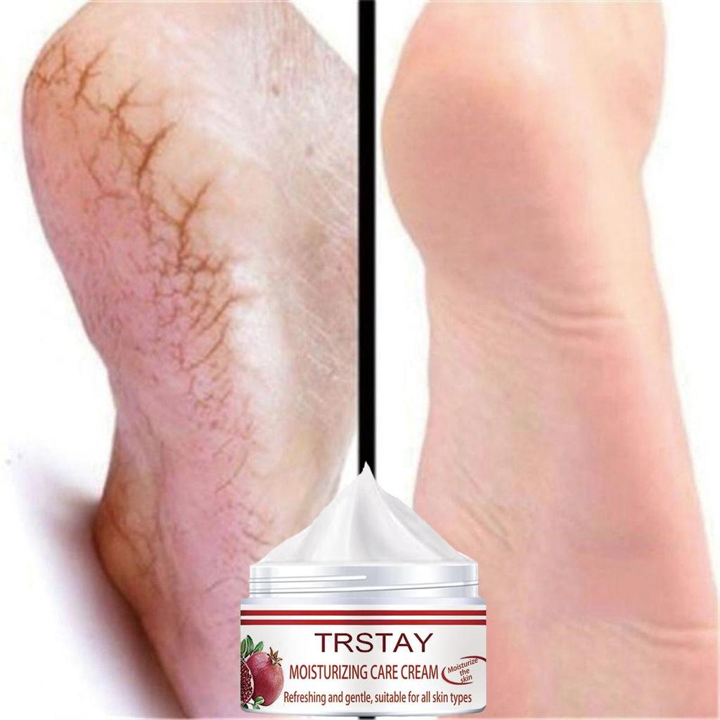 Sprukket Reparasjon Fjern Callus Dead Skin Care Antitørrmaske Eksfolierende sokker Føtpleie Fotbehandling