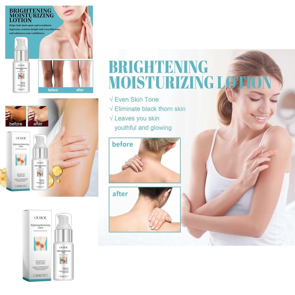 Ouhoe Nourishing Skin Whitening Cream For Underarms And Joints 30g Export Only