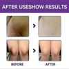 1-3pcs Women Vaginal Whitening Cream Lips Private Part Pink Underarm Intimate Nipple