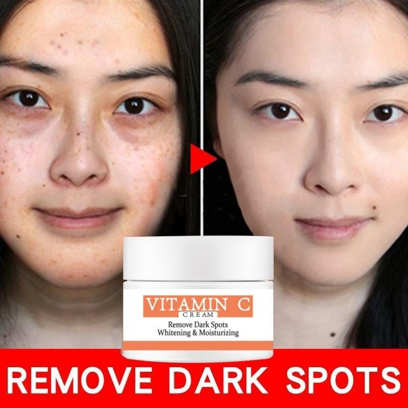 Cea mai nouă cremă de albire pentru față cu vitamina C, care repara pistruii decolorați, îndepărtează petele întunecate Cremă de față pentru înlăturarea melaninei