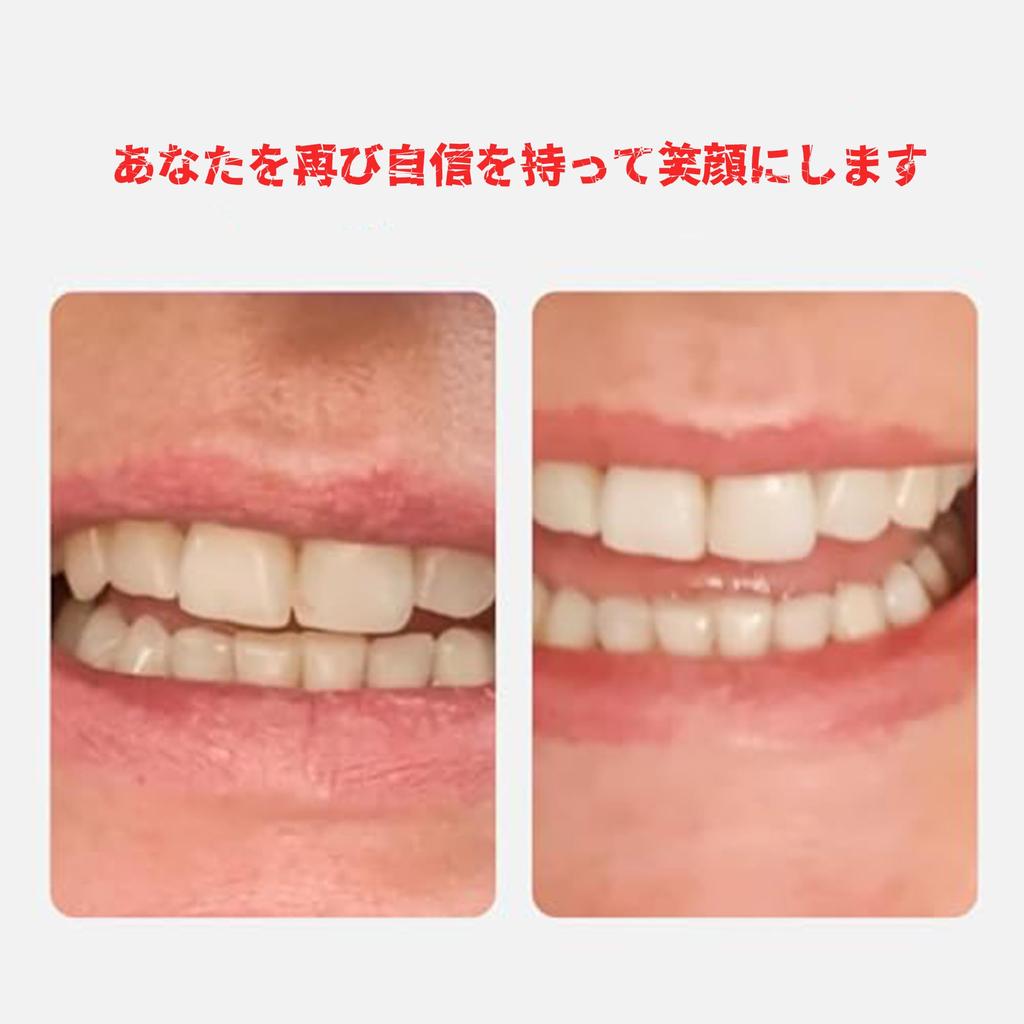 Krasada Make your own Denture temporary resin whitening oral care supplies Make your own dentures Drugstore Oral Care 2Pc dentures! materials, teeth,