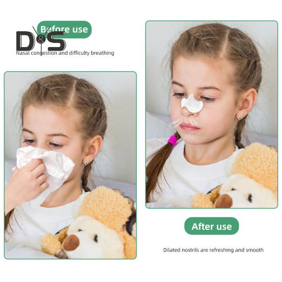 10Pcs Nose Breathing Nasal Strips Self Adhesive Curve Shape Secure Fit Anti-Snoring Nose Patches Sleep Aid for Adult Kids