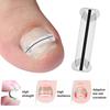 1Pcs Nail Correction Stickers Ingrown Toenail Corrector Patches Invisible High Strength Auxiliary Patch Paronychia Treatment