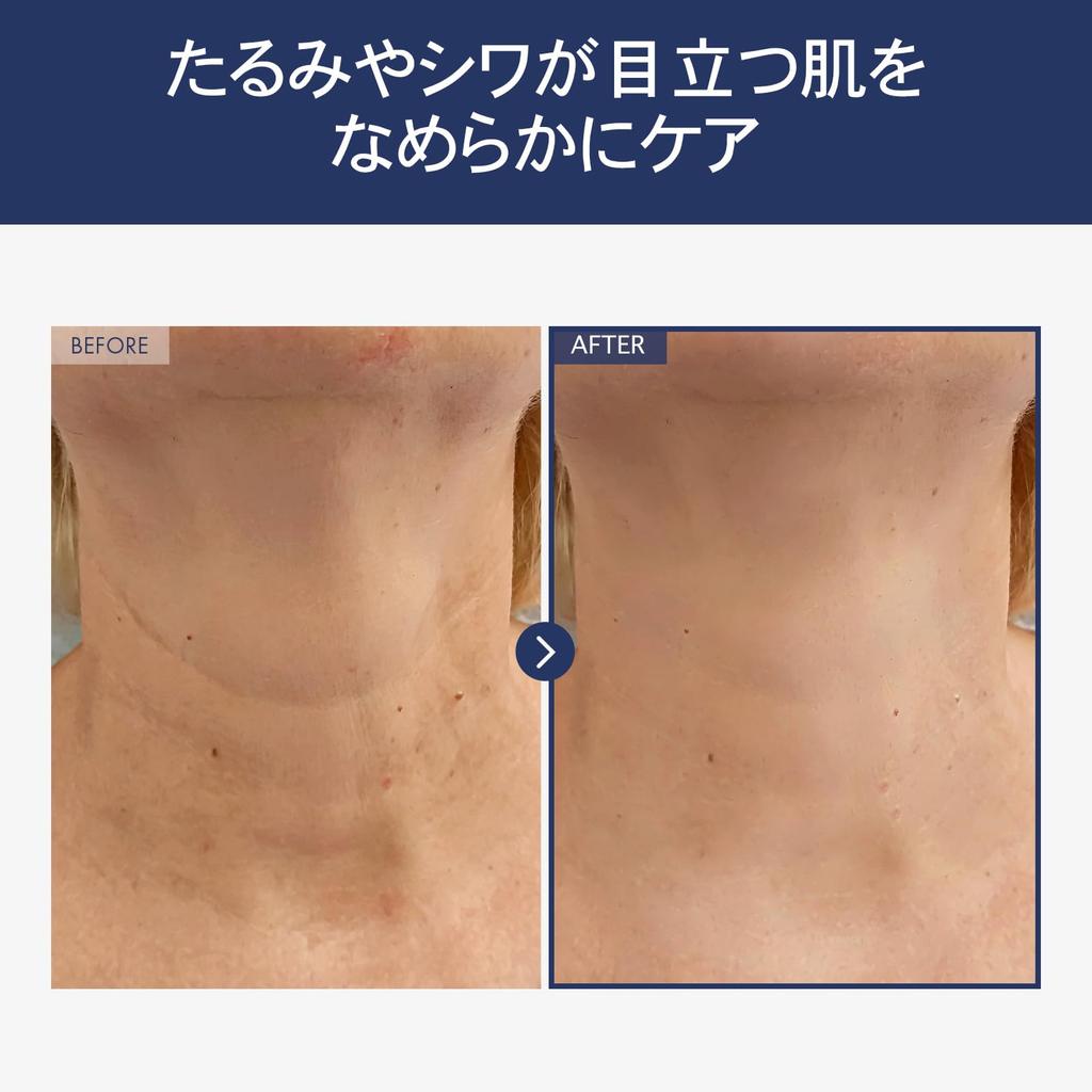 NATUREKIND Intensive Lifting Halscreme 50g - Halscreme für die Dekolleté-Pflege