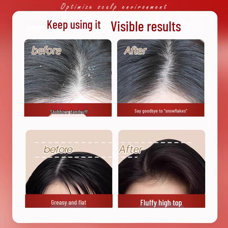 Miss Lilly Anti-Dandruff Oil Control Shampoo