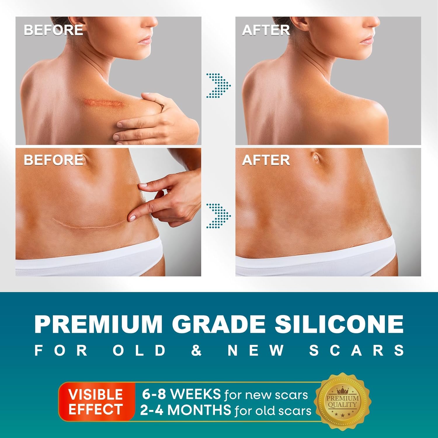 Silicone Scar Sheets, Silicone Scar Tape(1.6 x 120  Roll-300CM), Silicone Tape for Scars, Scar Tape for Surgical Scars, Silicone Scar Strips for