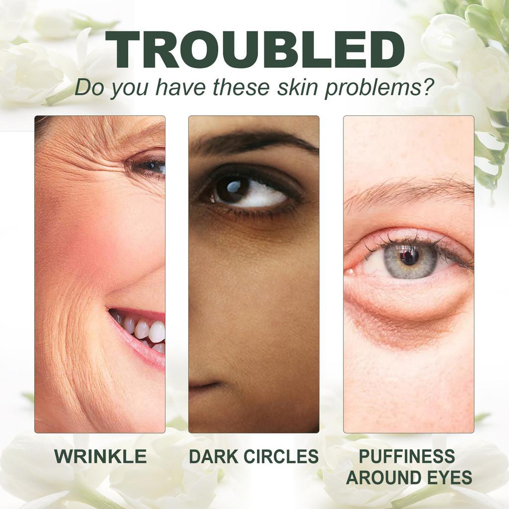 Jasmine Flower Anti-aging Eye Cream For Fine Lines And Puffiness Hydrating Complexion