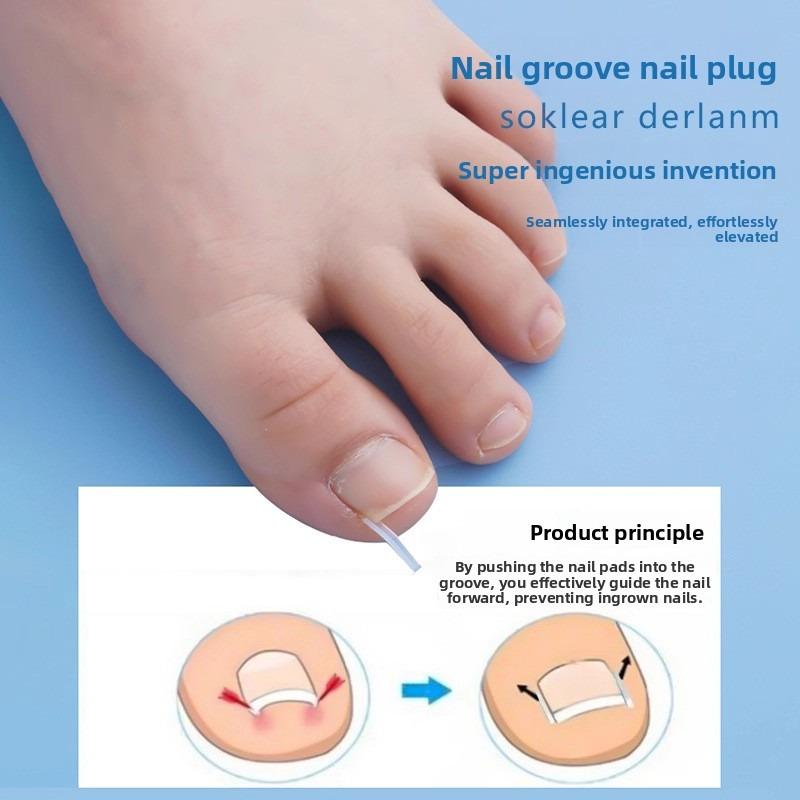 Palm Groove Nail Improvement Device for Ingrown Toenail, Foot Nail Prevention From Growing Into The Flesh, Proper Nail Correction Tool