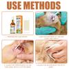 Pet Ear Cleaning Solution with Cotton Swabs, for Cats and Dogs To Remove Ear Mites, Relieve Itching, Clean Ears, Clear Ear Canals, and Deodorize